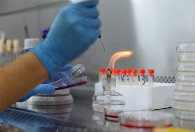 Лабораториски истражувач со заштитни ракавици работи со петриеви садови и примероци во микробиолошка лабораторија.